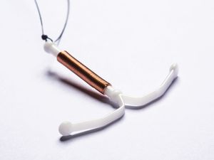 避孕铜IUD