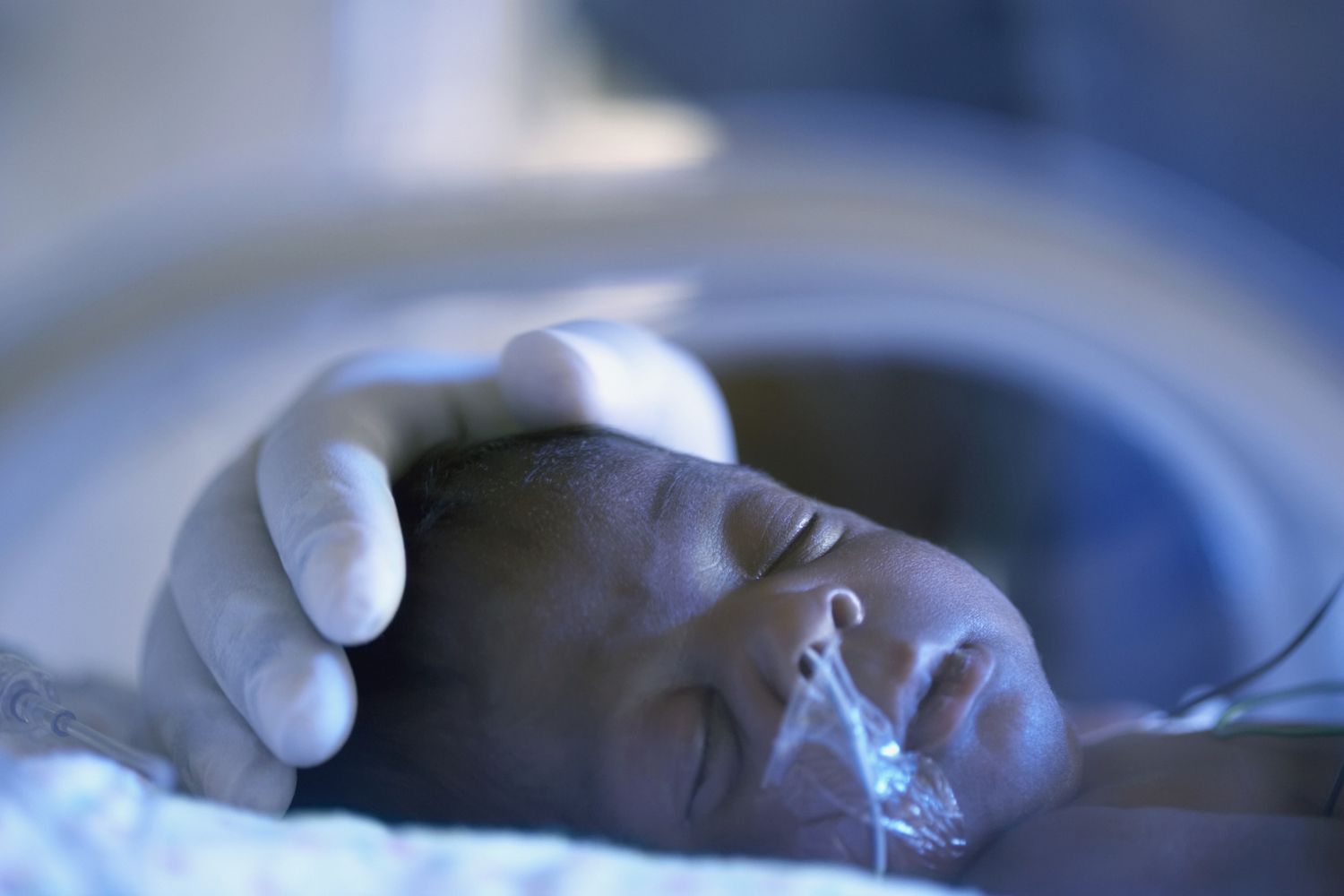Close up of African American premature baby