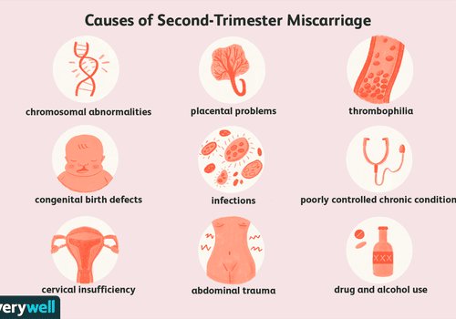 Causes of Second-Trimester Miscarriage