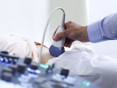 Pregnancy ultrasound scan