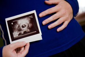 Pregnancy ultrasound