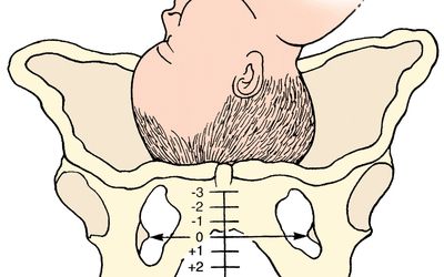 Illustration showing a babies head from the side above the pelvis bone