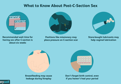 Post-C-Section Sex