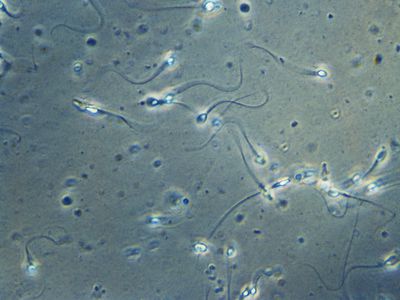 Human spermatozoa