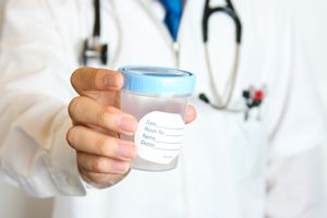 cup for a semen analysis