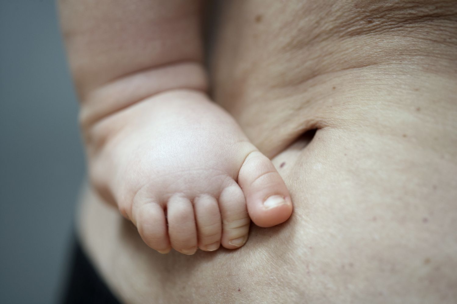 postpartum belly