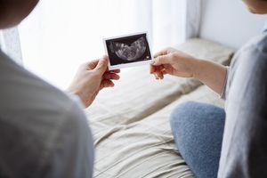 Mother and father holding an ultrasonography of their baby