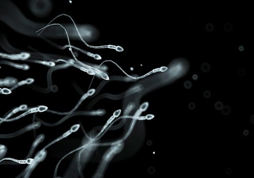 精子游动的计算机插图，不像精子坏死症，精子不移动