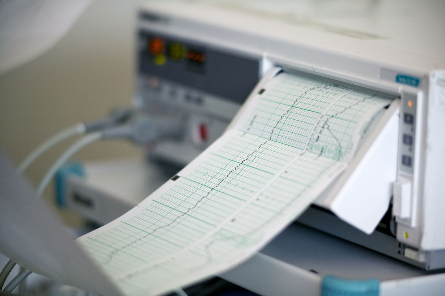 Fetal Monitor