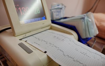 Fetal heart rate monitoring