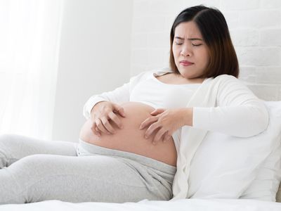 Southeast asian pregnant women itching of the skin belly which causes striped. Problems of pregnancy women and Stretch marks or striae concept