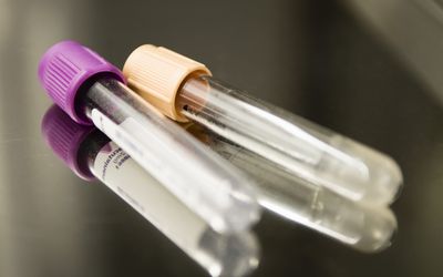 两个试管用于克罗米德挑战试验
