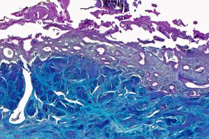 Cross section of endometrium, Uterus, Day 28, menses, micrograph 20x