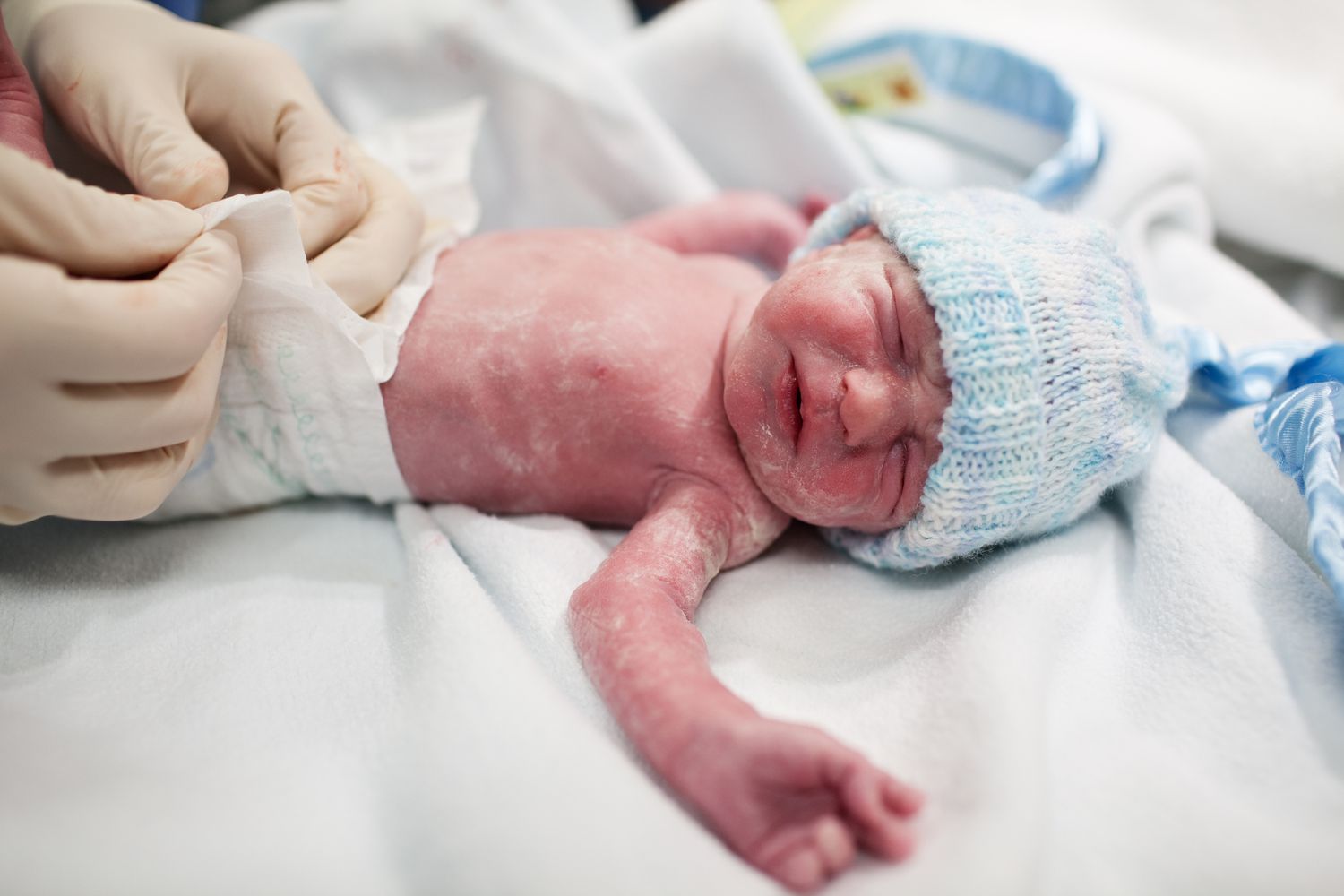 刚出生的婴儿戴着一顶帽子，上面覆盖着一层vernix
