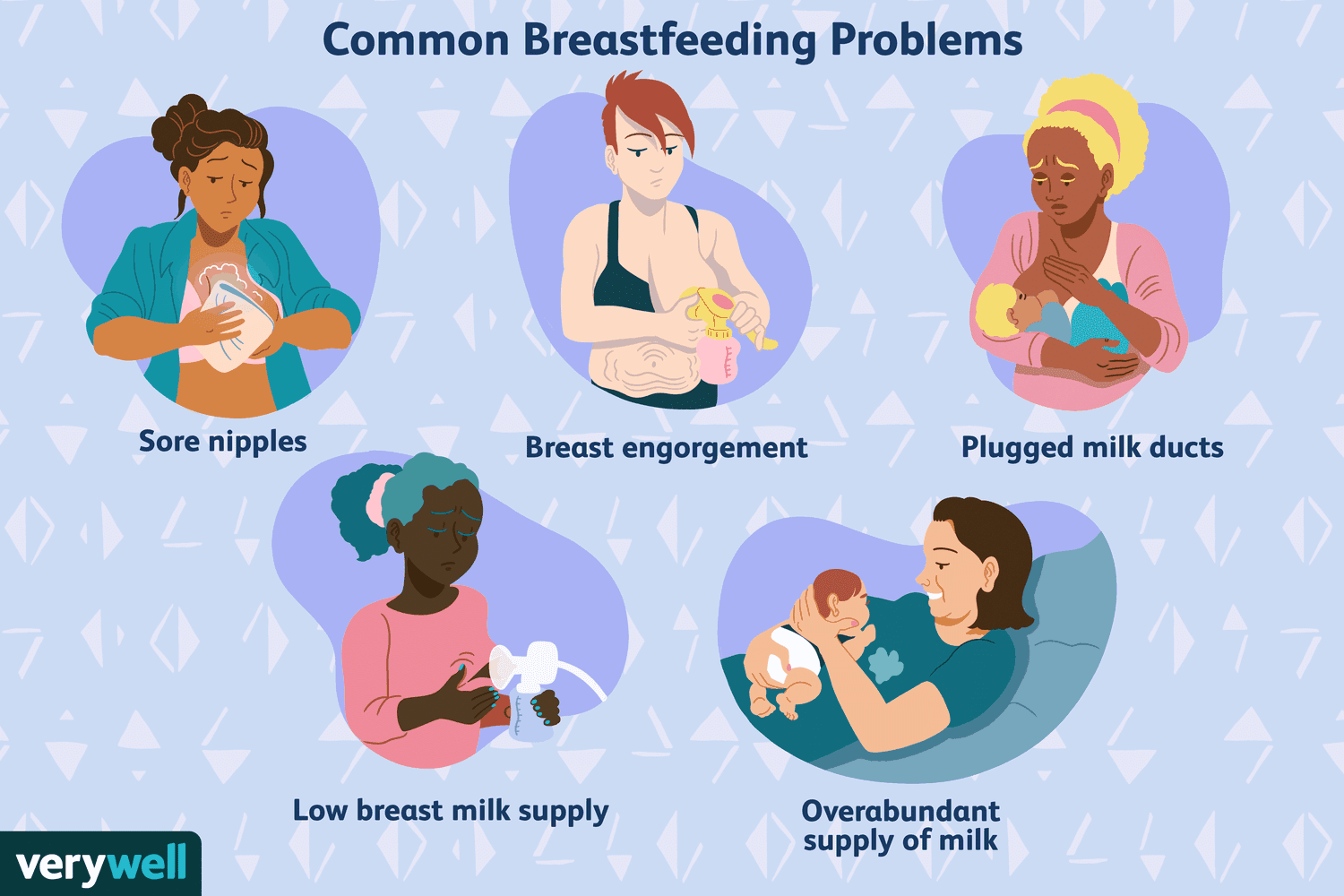 5个常见的母乳喂养问题