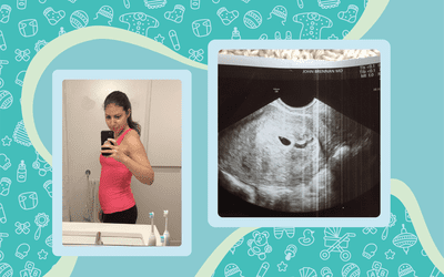 Elizabeth Narins' ultrasound