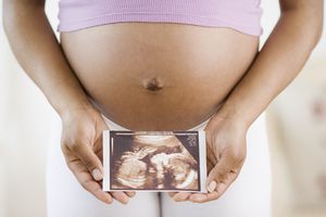 孕妇拿着一张超声波照片