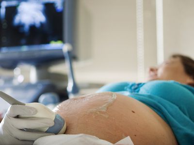 Pregnant woman getting an ultrasound