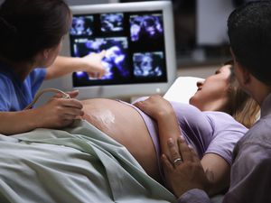 女医生指着孕妇的超声照片