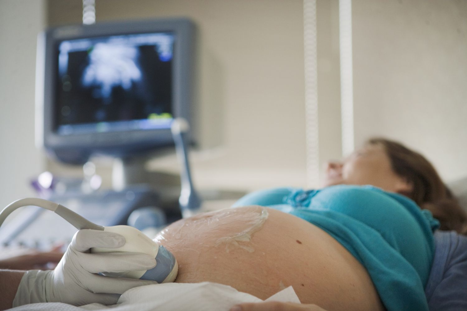 Pregnant woman getting ultrasound