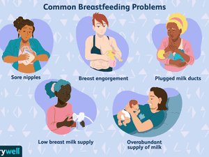 5个常见的母乳喂养问题的现场插图