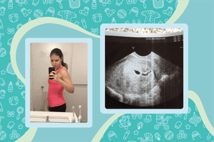 Elizabeth Narins' ultrasound